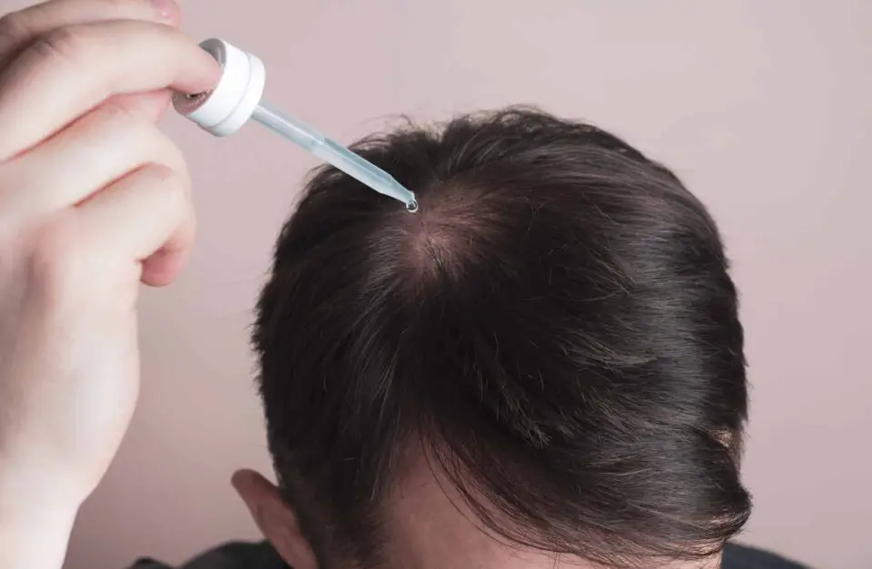 Rogaine Weight Gain Due to Topical (Over-the-Counter) Minoxidil — Rogaine